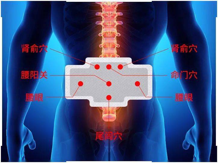 腰突腰肌劳损风湿性腰痛找准一个穴位每天一贴贴出铁腰板儿从.