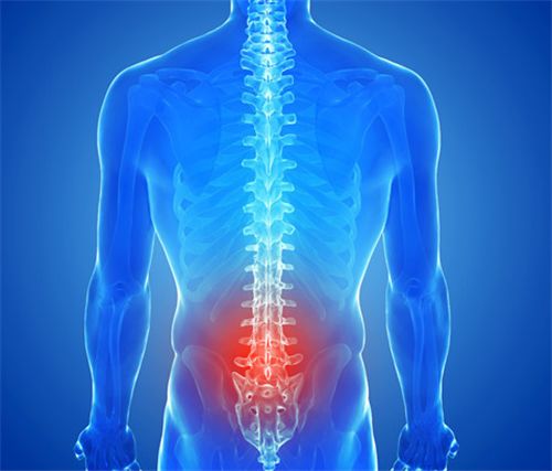 铁腰板治疗腰椎间盘突出是真的吗 老品牌品质效果有保障