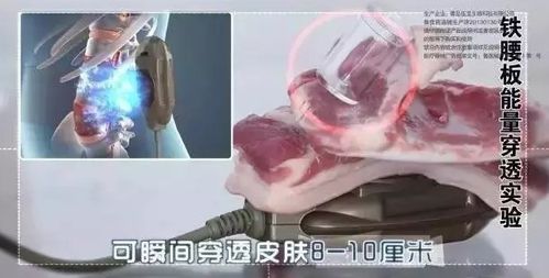 30年老腰突大妈 早接触铁腰板一天少遭一天罪,少花一分钱 治疗