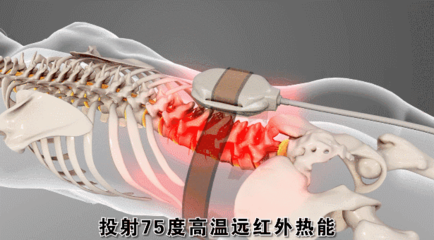 铁腰板治腰突好用吗 使用效果好放心安全