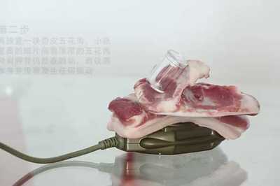 铁腰板治疗仪多少钱一台
